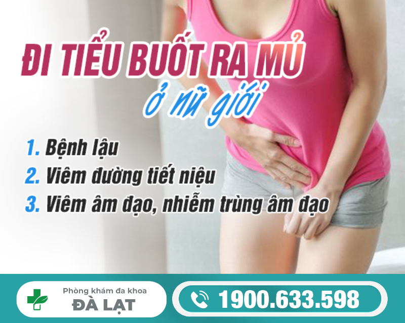 Hình ảnh minh họa